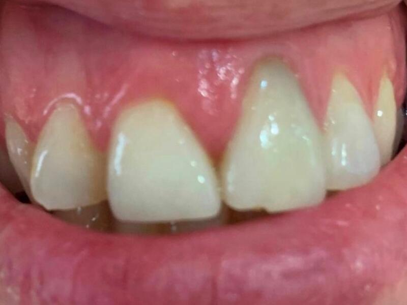 Before image