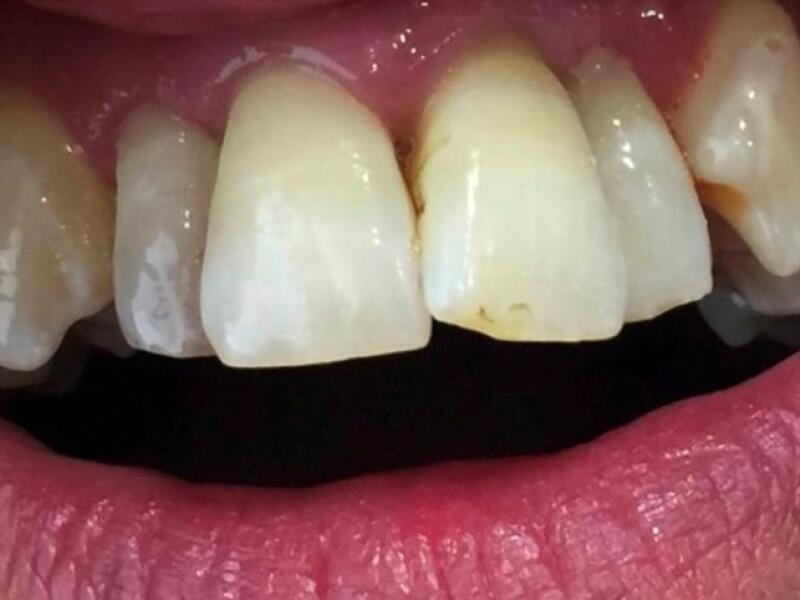 Before image
