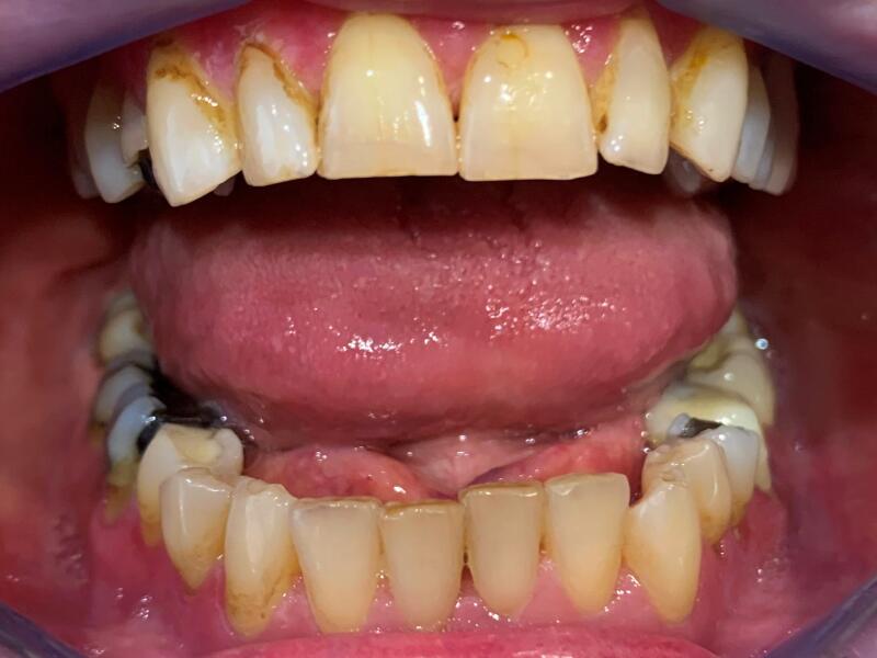 Before image