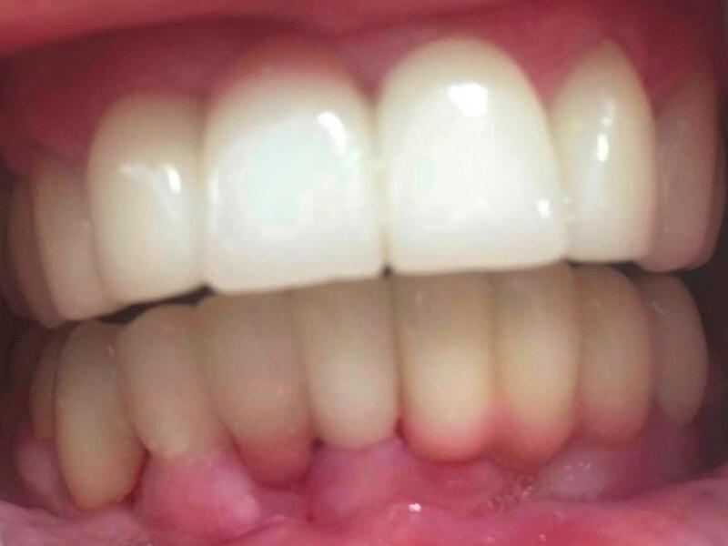 After image