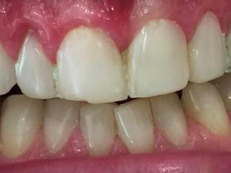 Before image