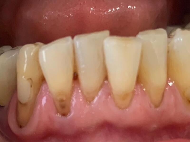 Before image